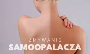 Kobieta z nierównomierną opalenizną. Tekst: "Zmywanie samoopalacza". Dowiedz się, jak pozbyć się samoopalacza.